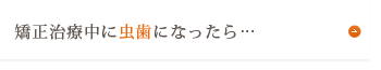 矯正治療中の虫歯予防